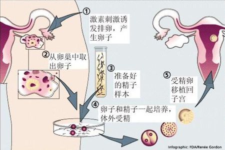 高龄二胎